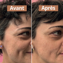 avant apres serum anti age comme avant